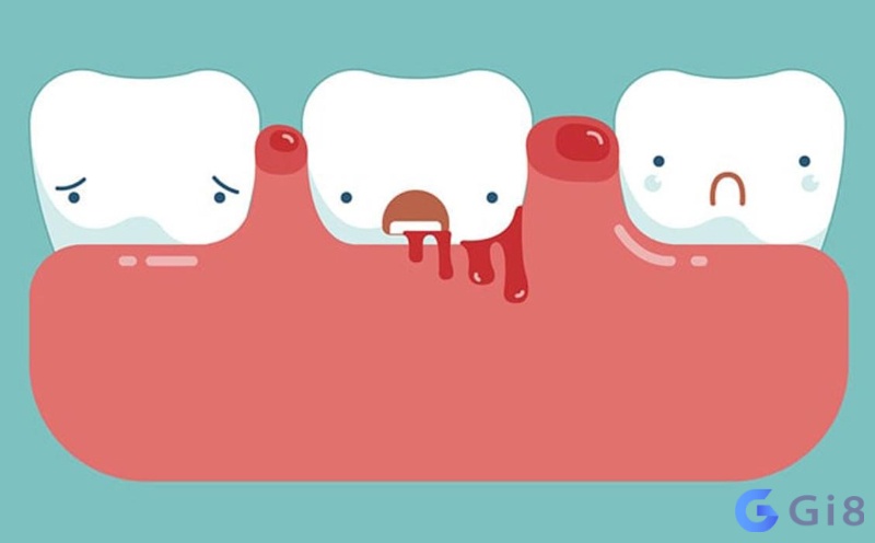 Mơ thấy răng bị rụng chảy máu có thể là dấu hiệu sức khỏe giảm sút